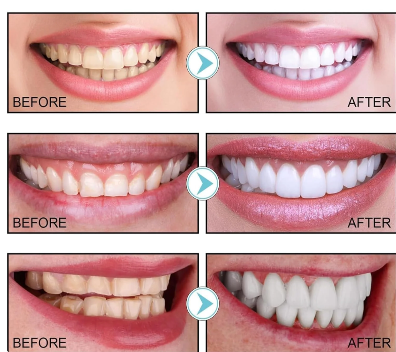 Pasta dental blanqueadora con niacinamida Herblix™
